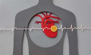 Study provides insights on ideal DOAC timing for patients with AFib post stroke