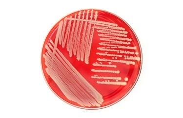 Research attempts to fill knowledge gap for vancomycin loading dose practice