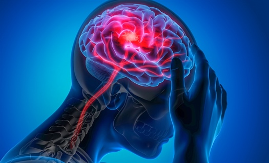 Early management of patients with acute ischemic stroke: 2019 update